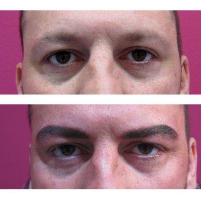 Microblading para hombre